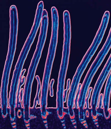 S6673 Flu Viruses Can Damage Cilia, The Hair-Like Fibers Lining The Respiratory Tract That Move Bacteria And Mucous &Quot;Where We Can Cough Them Out&Quot; Of The Lungs, He Explained. That Can Make People Susceptible To Pneumonia And Other Bacterial Infections — A Scenario Blamed For Many Flu Deaths In Otherwise Healthy Children And Adults, He Said. In These Cases, Flu Patients Often Appear To Get Better, But Then Fever And A Cough Return.