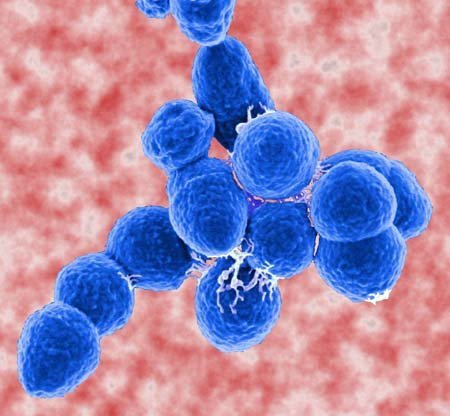 streptococcus_20pneumoniae Streptococcus pneumoniae