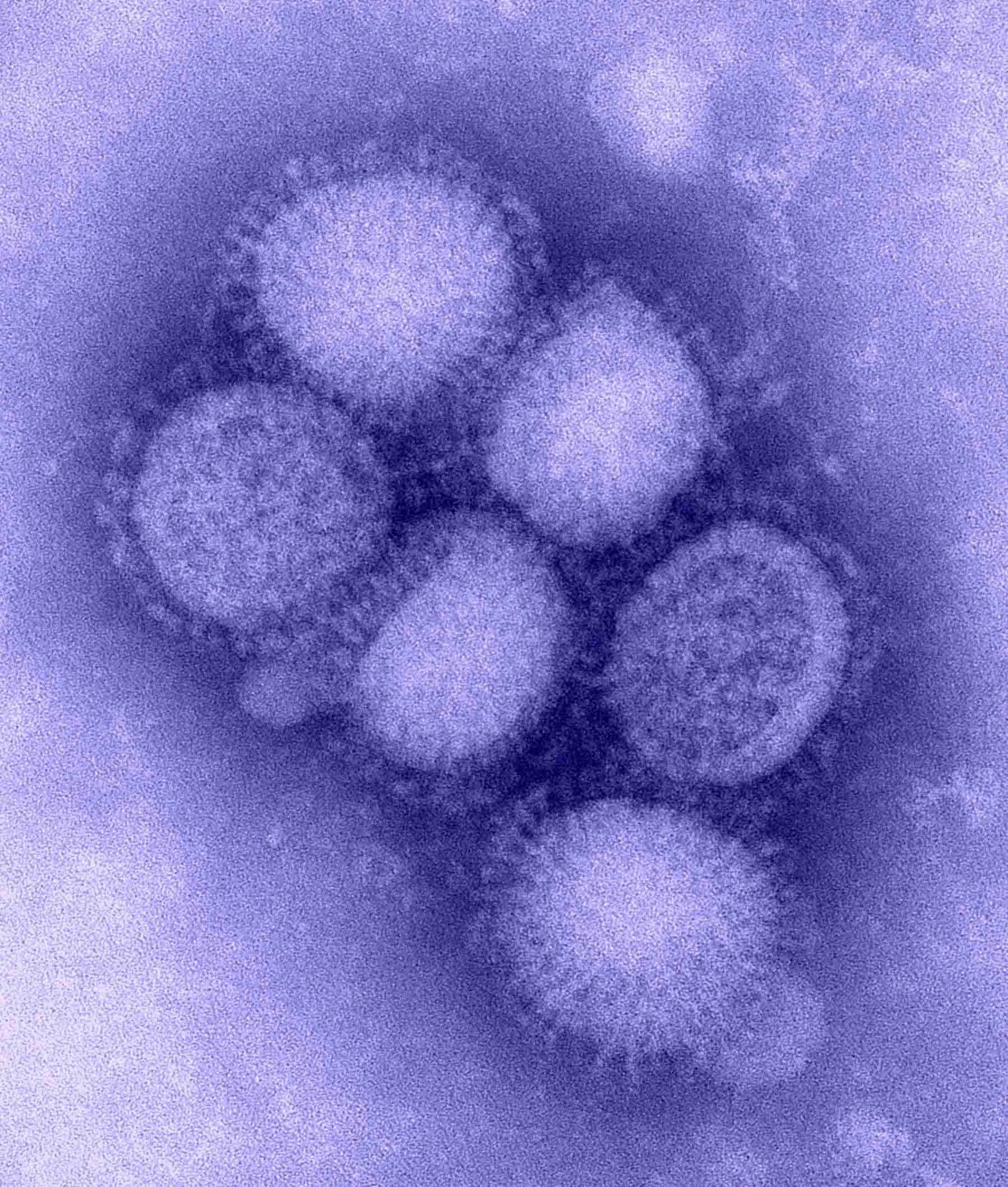 B00528 H1N1 Flu Blue Lrg