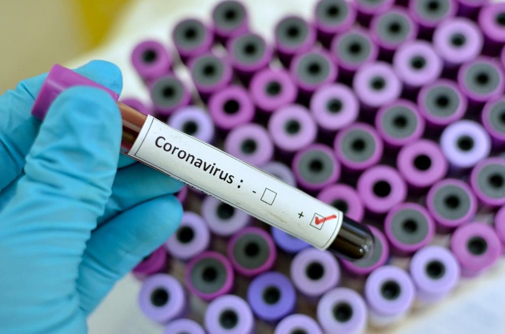 Coronavirus Testtube 1